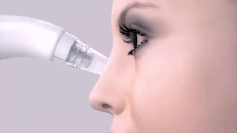 DEEPLY REMOVE BLACKHEADS