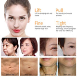 THERMAGE FACIAL RF RADIO FREQUENCY FOR FACE LIFTING
