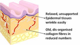 THERMAGE FACIAL RF RADIO FREQUENCY FOR FACE LIFTING