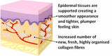 THERMAGE FACIAL RF RADIO FREQUENCY FOR FACE LIFTING